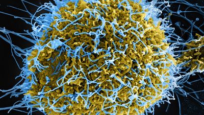 ebolavirus; Ebola virus disease